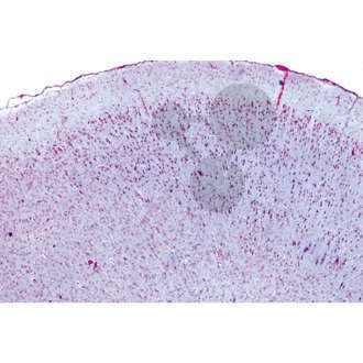 Histologie: Nervensystem 10 Mikropräparate