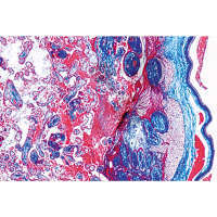 Prép. Micro. Structure du placenta humain