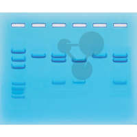 COVID-19 Testung mittels PCR