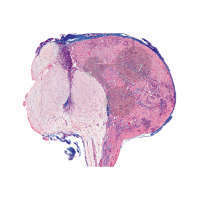 Hypophyse (Hirnanhangsdrüse) vom Schwein, sagittal längs