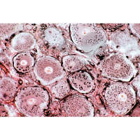 Golgi-Apparat in den Zellen des Spinalganglions