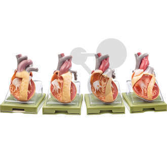 Modellserie mit der Darstellung angeborener Herzfehler SOMSO®-Modell