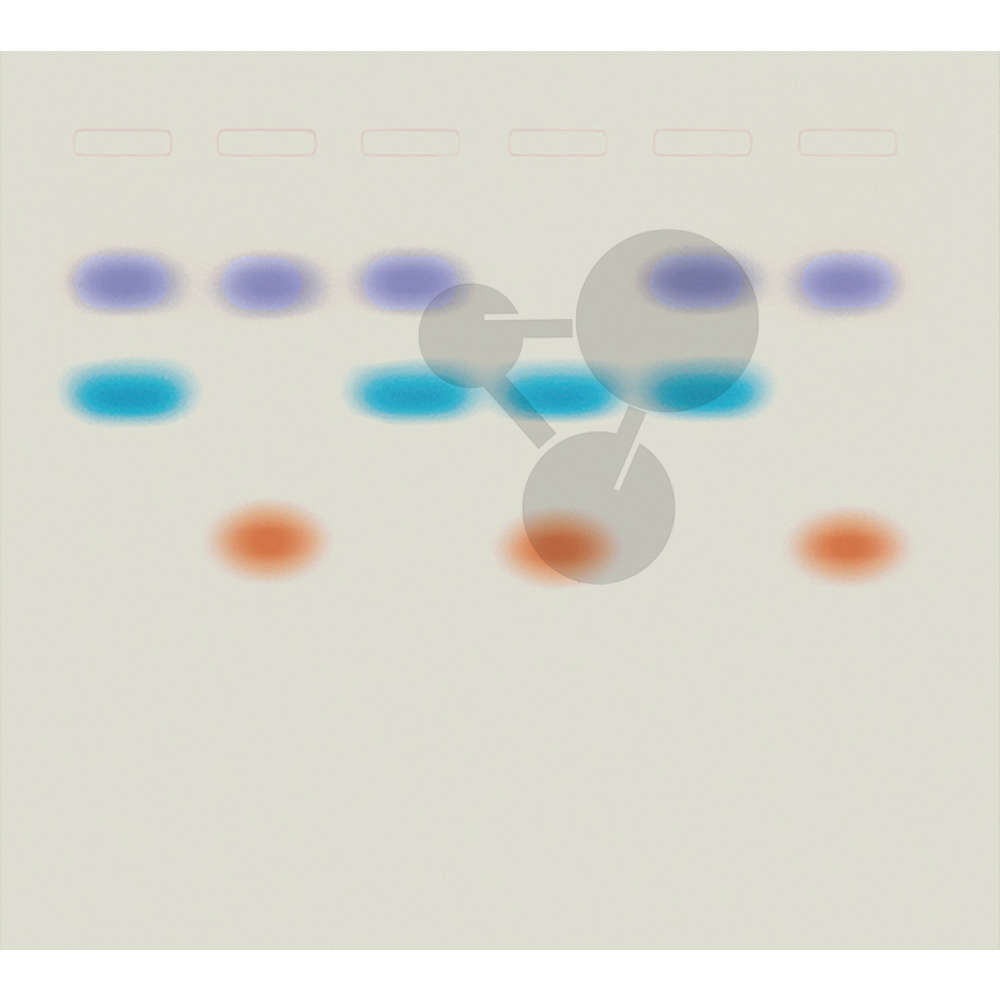 DNA-Spurensuche