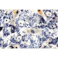 Mitochondrien in den Zellen von Leber oder Niere