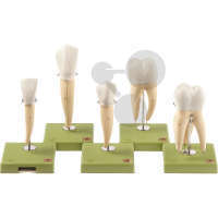 Fünf Zahnmodelle SOMSO®-Modell