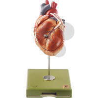 Herzmodell mit Bypassgefäßen (aortakoronarer Venenbypass) SOMSO®-Modell
