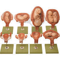 Schwangerschaftsserie SOMSO®-Modell