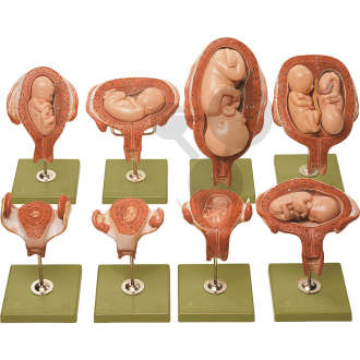 Schwangerschaftsserie SOMSO®-Modell
