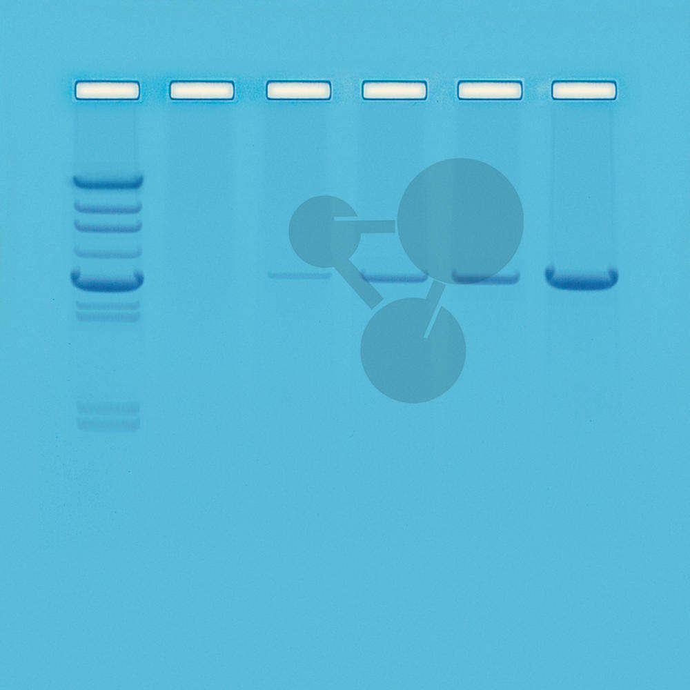 Polymerasekettenreaktion (PCR) - eine Einführung