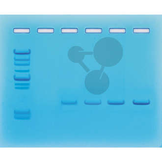 DNA-Amplifikation mittels PCR