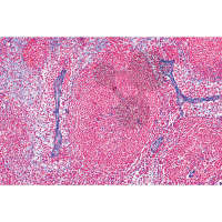 Histologie: Lymphsystem 6 Mikropräparate